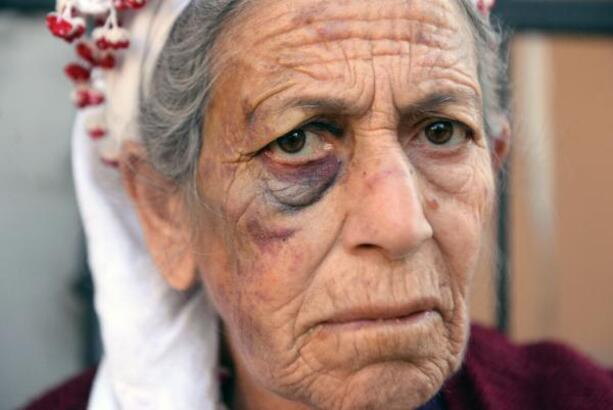 72 yaşındaki kanser hastası kadını bayıltana kadar dövüp, para ve altınlarını aldı
